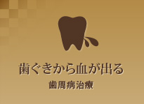 歯ぐきから血が出る歯周病治療