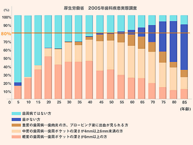 日本人の成人の8割が歯周病予備軍